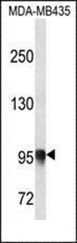 PLOD3 antibody