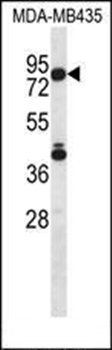 SGPL1 antibody