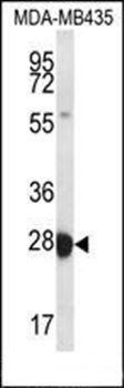 RAB27B antibody