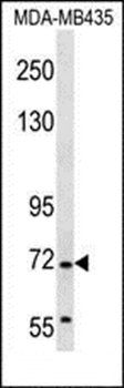 GRHL2 antibody