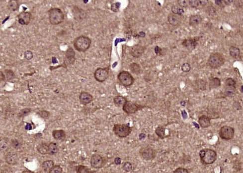 DRP1 (phospho-Ser616) antibody