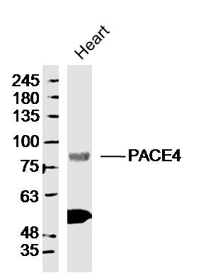 PACE4 antibody