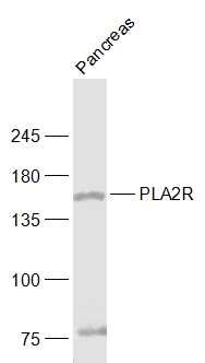 PLA2R antibody