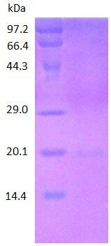 CD8b protein