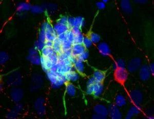 Anti-Doublecortin Antibody