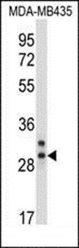 CELA2A antibody