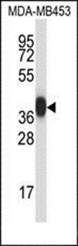 PRSS8 antibody