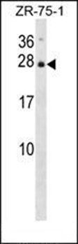 IL25 antibody