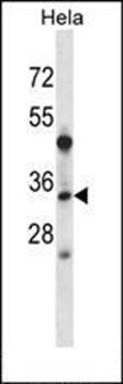 LAT2 antibody