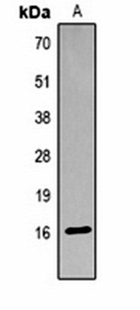 Histone H3 (AcK18) antibody