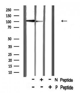 CTIP (Phospho-Ser327) antibody