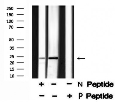 TPPP (Phospho-Ser18) antibody