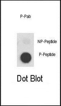 MET (phospho-Tyr1356) antibody