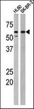 MYT1 (phospho-Thr495) antibody