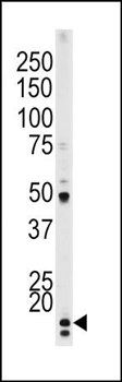 P21CIP1 (phospho-Thr145) antibody