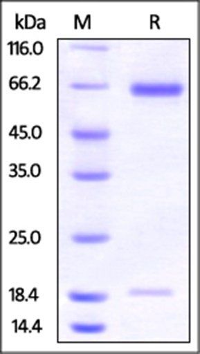 Hamster PCSK9 Protein, His Tag