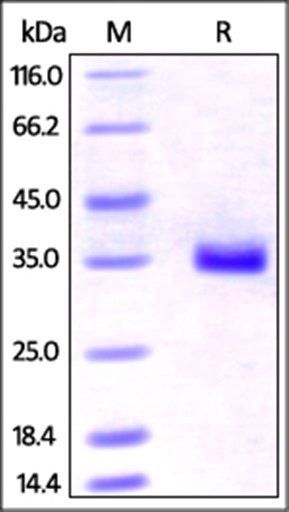 Human IGFBP-7 Protein, His Tag
