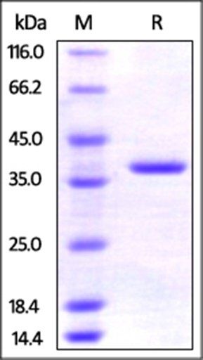 Human AIMP1 Protein, His Tag