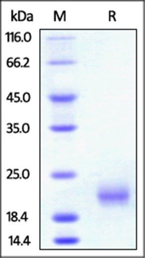 Rat GITR / TNFRSF18 Protein