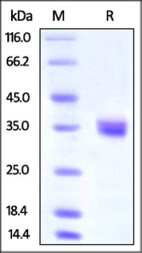 Human IGFBP-4 Protein, His Tag