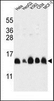 HIST1H2AL antibody