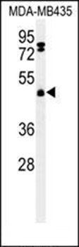 FBXL2 antibody