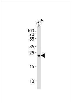 RSPO2 antibody