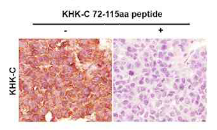 KHK Isoform C Antibody