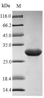 Rat S100a9 protein