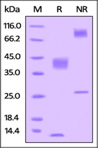 Human Latent TGF-beta 1 / TGFB1 Protein