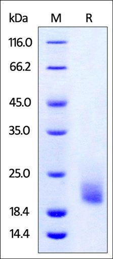 Cynomolgus / Rhesus macaque TIGIT Protein, His Tag