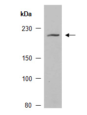 KDM5D antibody