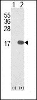 IL1F8 antibody