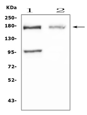 Niemann Pick C1/NPC1 Antibody