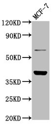 LAPTM4B Antibody
