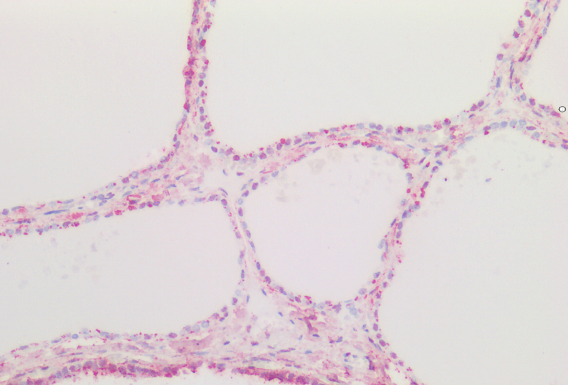 Goat anti-CTGF (aa111-123) Antibody