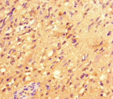 ACOD1 antibody