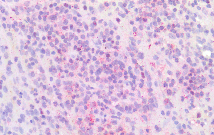Goat anti-IRF4 (aa393-407) Antibody