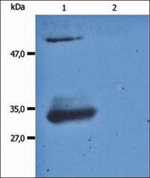 Mouse Anti-Human IgG (Fab) antibody (PE)