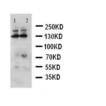 Anti-ADAMTS4/ADAMTS4 Antibody