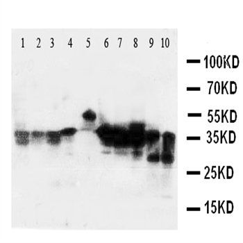 Anti-AIMP2/p38 Antibody