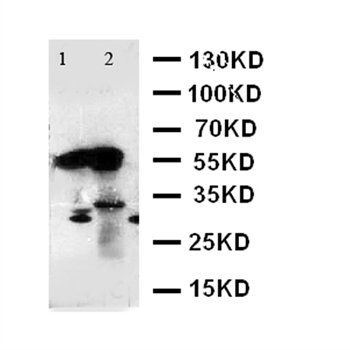 Anti-Alpha Amylase 1/AMY1A Antibody