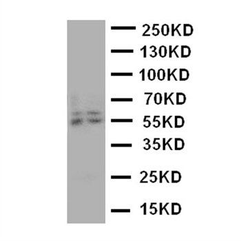 Aromatase/CYP19A1 Antibody