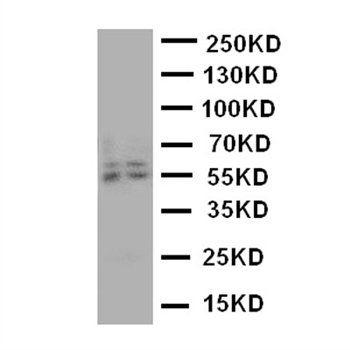 Anti-Aromatase/CYP19A1 Antibody