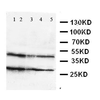 GPR2/CCR10 Antibody