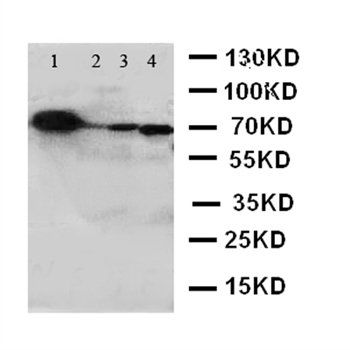 Anti-GCLC Antibody
