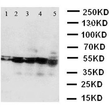 Anti-BCAT2 Antibody