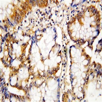 Anti-Caspase-10/CASP10 Antibody