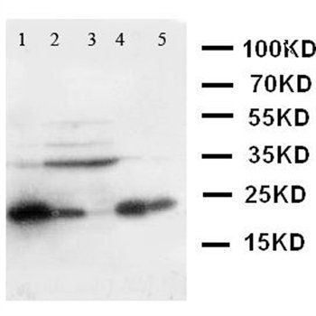 Anti-Caveolin-1/CAV1 Antibody