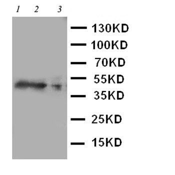 Anti-C-C chemokine receptor type 4 CCR4 Antibody